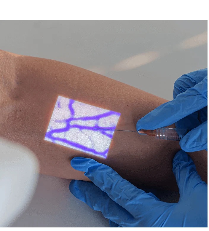 Vein Finder Devices